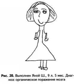 еороткие руки